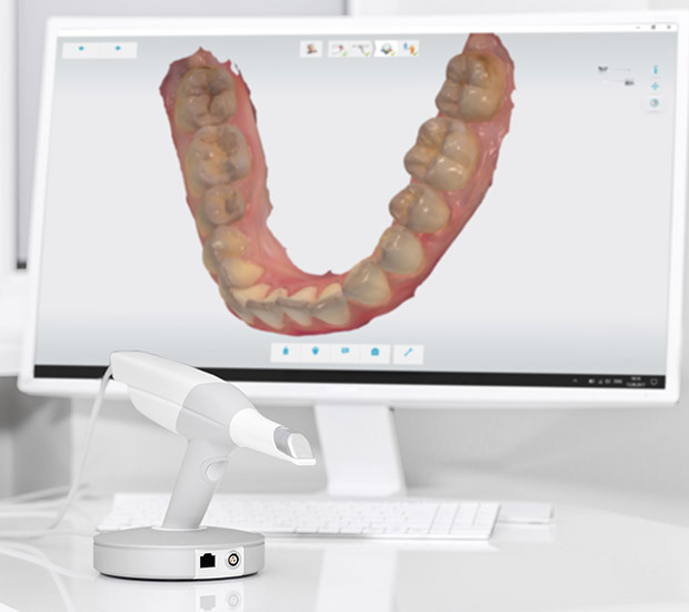Cypress 3D Cone Beam and 3D Dental Scans