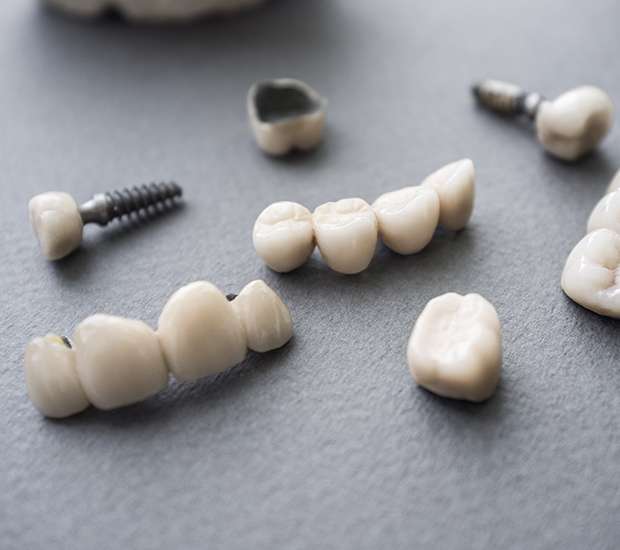 Cypress The Difference Between Dental Implants and Mini Dental Implants