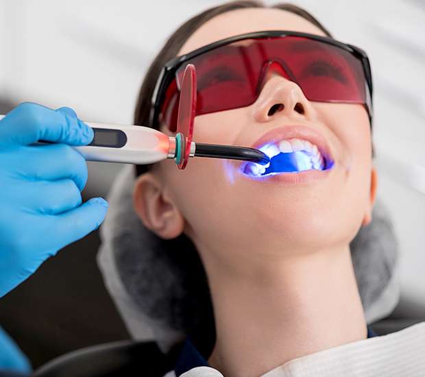 Cypress Professional Teeth Whitening